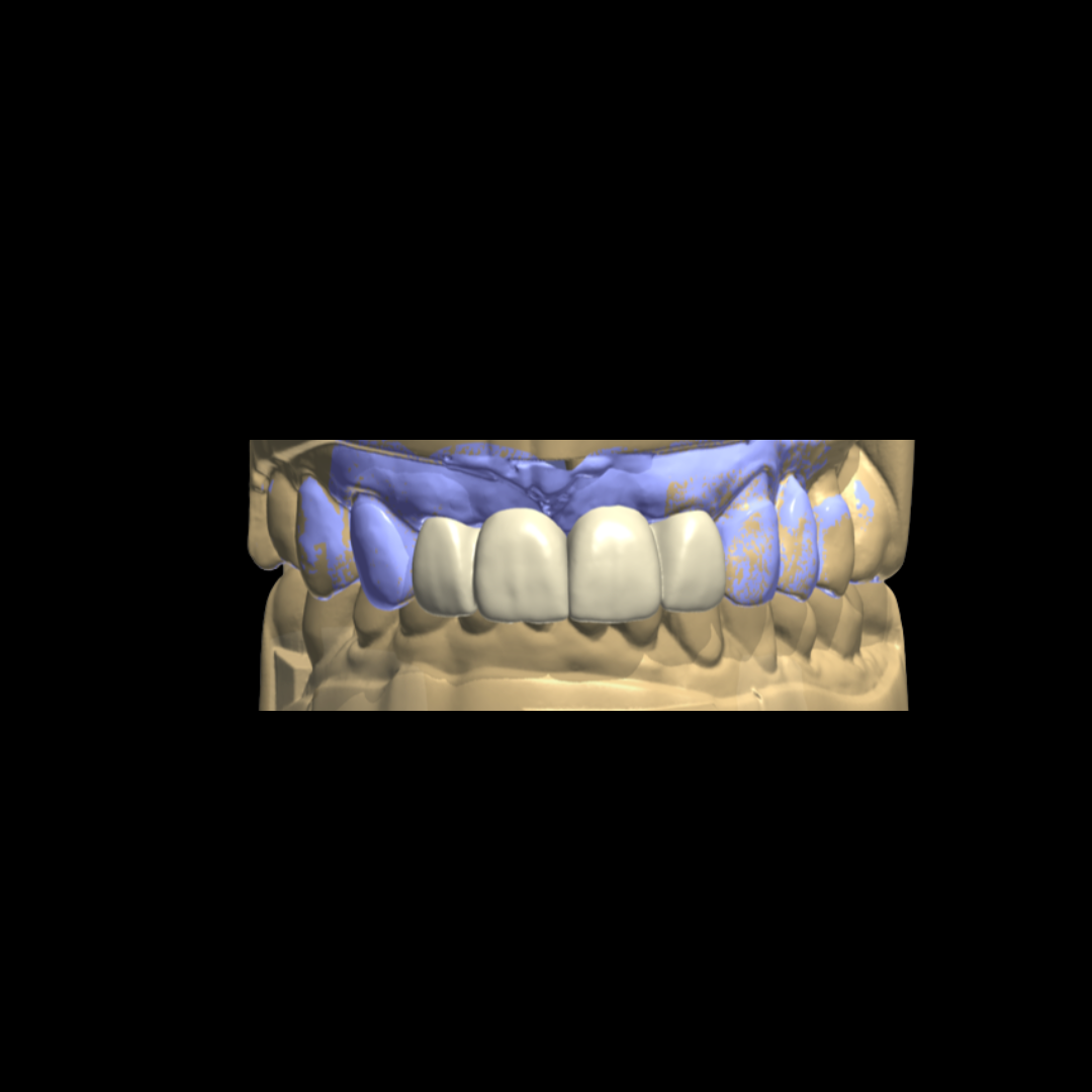Digital cosmetic smile imaging